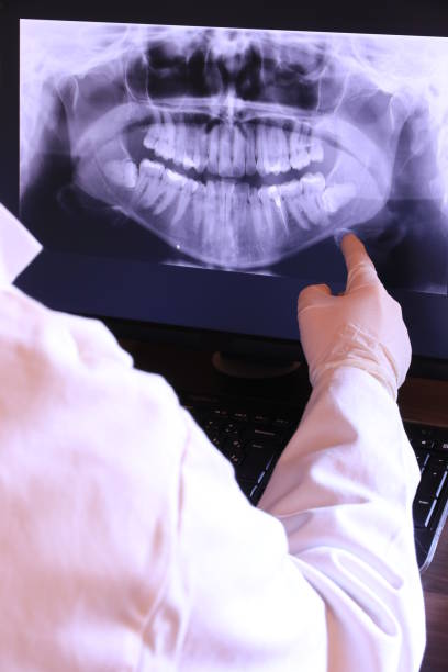 Best Emergency Dental Care for Broken or Chipped Teeth in Lagrange, OH